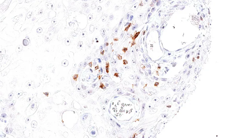 TIGIT IHC, overview and detail.