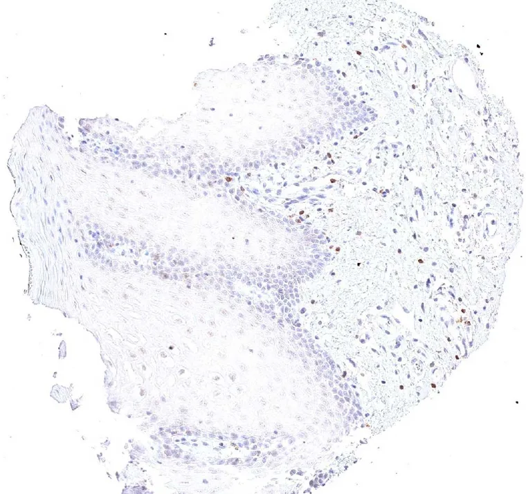 Oral mucosa with TIGIT positive lymphocytes in the subepithelial stroma.