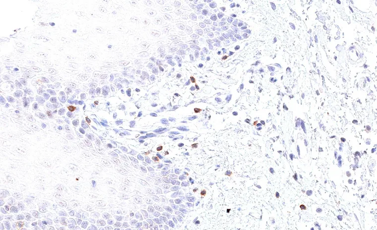 Oral mucosa with TIGIT positive lymphocytes in the subepithelial stroma.
