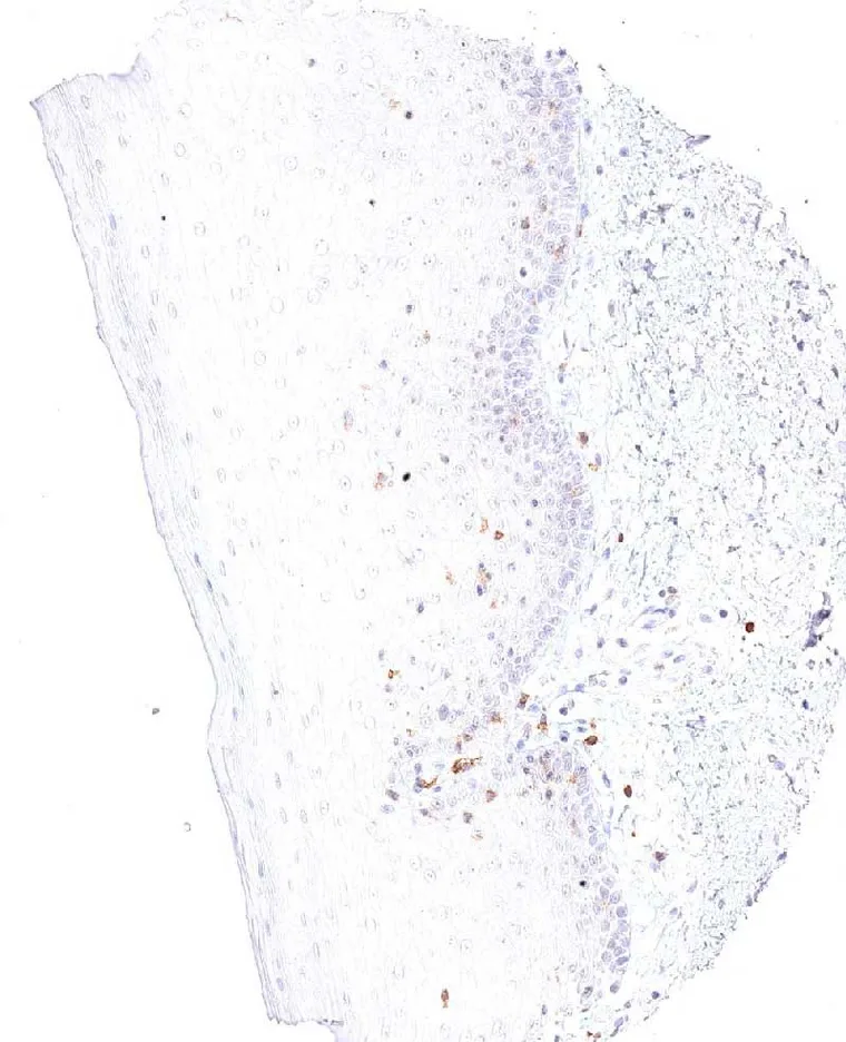 Oral mucosa with intraepithelial and subepithelial TIGIT positive lymphocytes.