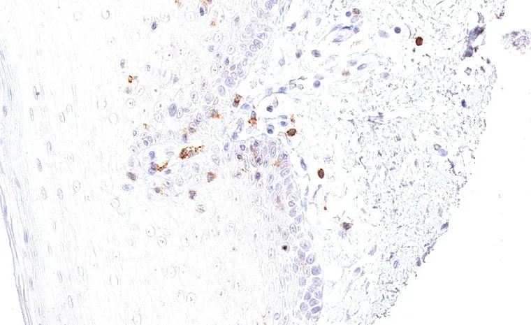 Oral mucosa with intraepithelial and subepithelial TIGIT positive lymphocytes.