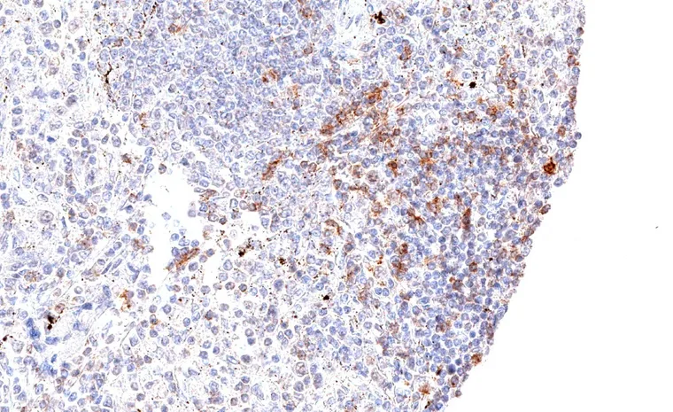 Abundant TIGIT positive lymphocytes in the spleen.