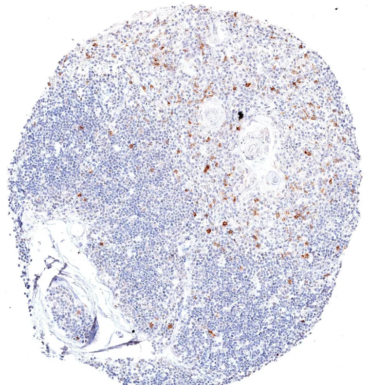 TIGIT positive lymphocytes are frequent in the thymus.