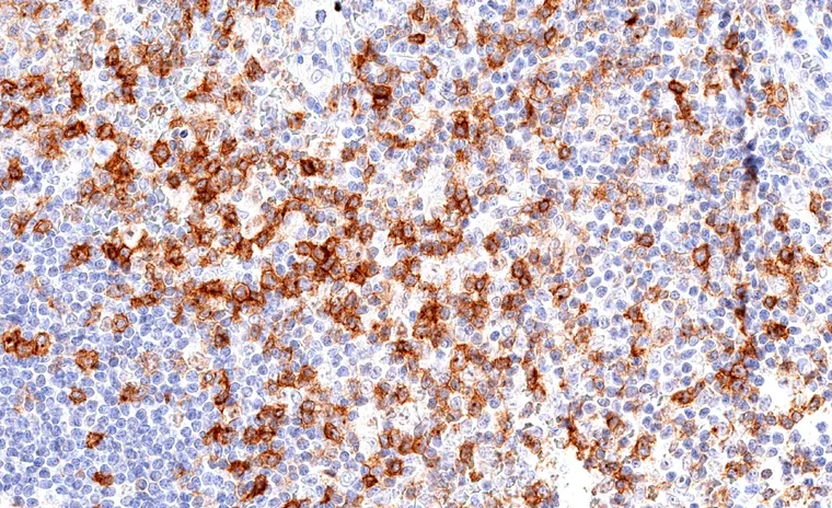 TIGIT positive lymphocytes are abundant in the mucosa of the appendix.