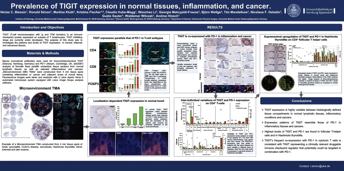 Congress poster: Prevalence of TIGIT expression in normal tissues, inflammation, and cancer (AACR Annual Meeting 2018)
