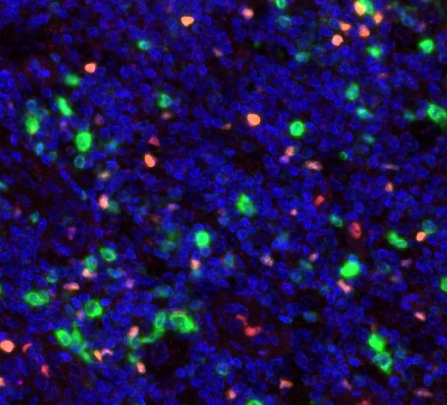 Multicolor immunofluorescence of FOXP3 (red; anti-FOXP3 clone FX3, DIA-FX3) and CD112R/PVRIG (green; anti-CD112R clone R12, DIA-R12), magnification 40×, normal human tonsil – figure 02 of the previous ONCOdianova FOXP3 gallery and figure C of the datasheet (both antibodies as named in the datasheet legend; nuclei blue).