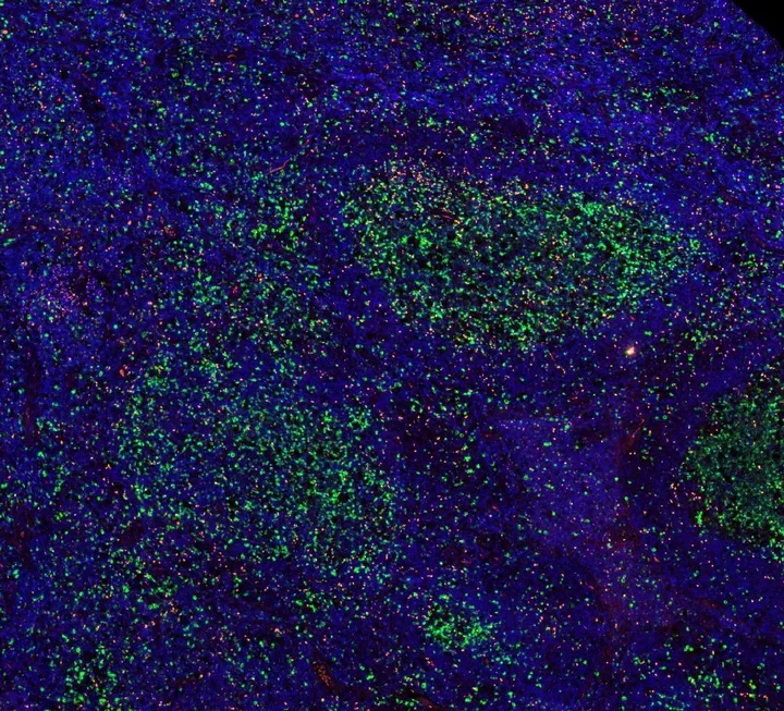 Multicolor immunofluorescence of FOXP3 (red; anti-FOXP3 clone FX3, DIA-FX3) and CD112R/PVRIG (green), magnification 4×, normal human tonsil – figure 01 of the previous ONCOdianova FOXP3 gallery.