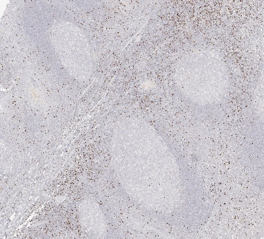 Immunohistochemistry of human FOXP3 with anti-FOXP3 clone FX3 (DIA-FX3) in FFPE tissue – FOXP3-positive cells in tonsil, overview; the source file name designates the tissue as tonsil, 5×; figure 08 of the previous ONCOdianova FOXP3 gallery.
