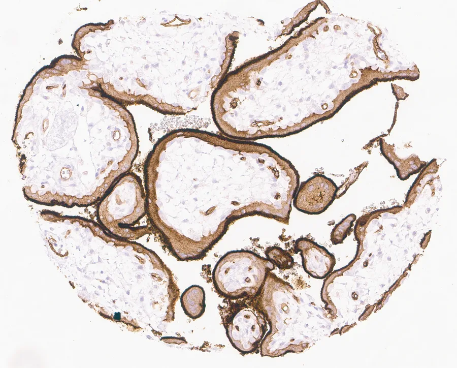 Immunohistochemistry of human CD73 (NT5E) with anti-CD73 clone KK3 (DIA-KK3) in FFPE tissue – strong CD73 positivity of the superficial membrane of the syncytiotrophoblast in placenta; figure 09 of the previous ONCOdianova CD73 gallery.