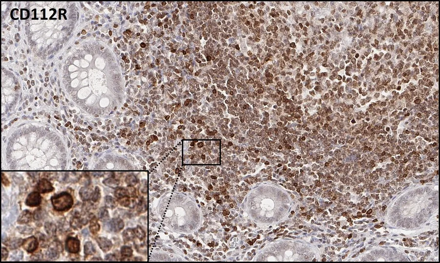 Immunohistochemistry of human CD112R/PVRIG with anti-CD112R/PVRIG clone R12 (DIA-R12) in FFPE tissue – brightfield IHC, figure 03 of the previous ONCOdianova CD112R gallery.