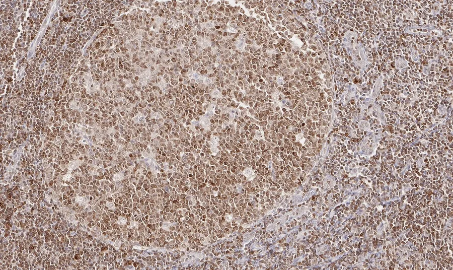 Immunohistochemistry of human CD112R/PVRIG with anti-CD112R/PVRIG clone R12 (DIA-R12) in FFPE tissue – brightfield IHC, figure 06 of the previous ONCOdianova CD112R gallery.