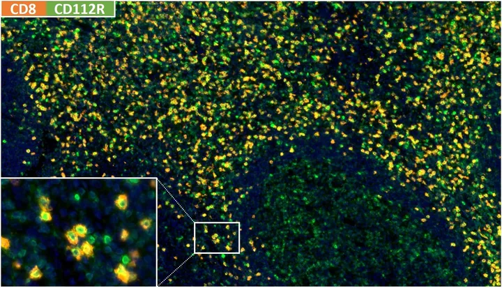 Fluorescence multiplex immunohistochemistry of a normal human tonsil with anti-CD8 (DIA-TC8; orange/red) and anti-CD112R/PVRIG clone R12 (DIA-R12; green), nuclei blue – figure 01 of the previous ONCOdianova CD112R gallery.