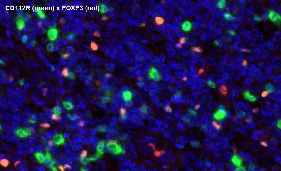 Multicolor immunofluorescence of CD112R/PVRIG (green; clone R12) and FOXP3 (red), magnification 40×, normal human tonsil – figure 15 of the previous ONCOdianova CD112R gallery (legend quoted from the source).