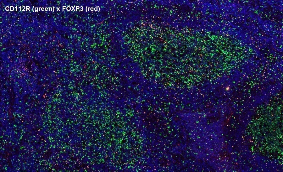 Multicolor immunofluorescence of CD112R/PVRIG (green; clone R12) and FOXP3 (red), magnification 4×, normal human tonsil – figure 14 of the previous ONCOdianova CD112R gallery (legend quoted from the source).