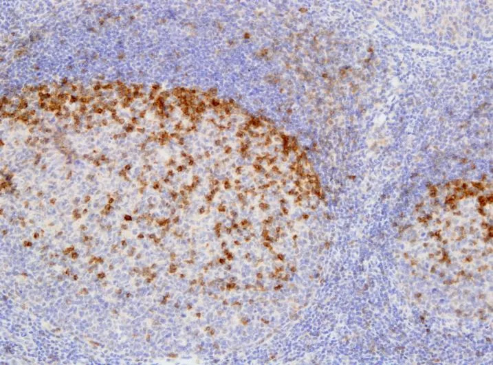 TIGIT IHC on tonsil after heat-induced epitope retrieval at pH 9.0 (left) versus pH 6.0 (right), Leica Bond RX (ONCOdianova reference images, Tech Note V1, p. 5). – HIER pH 9.0