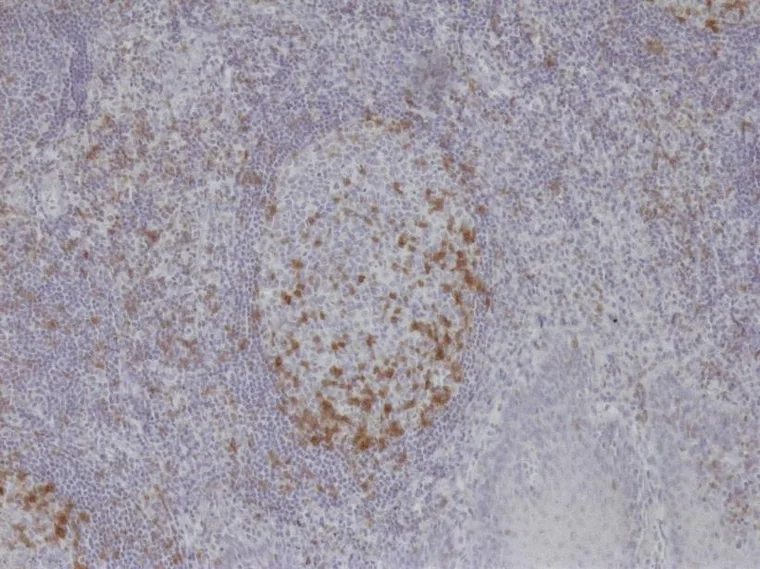 Microphotographs of TG-1 immunostaining on human tonsil at 100×, 200× and 400× (ONCOdianova reference images, Tech Note V1, Fig. 1). – 100×