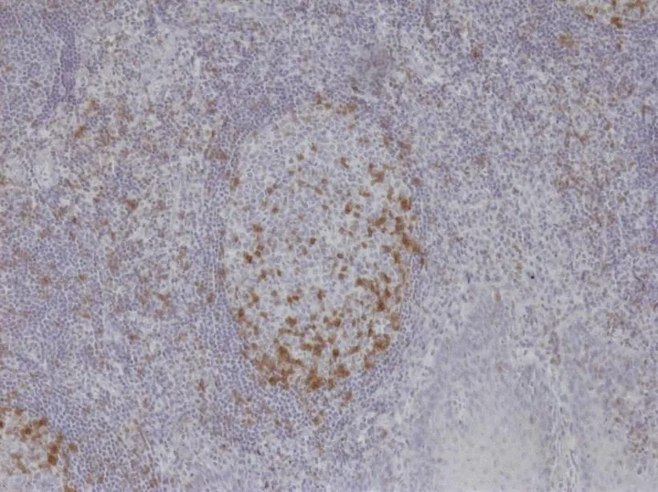 TG-1 immunostaining on human tonsil at 100× (ONCOdianova reference image, Tech Note V1, Fig. 1).