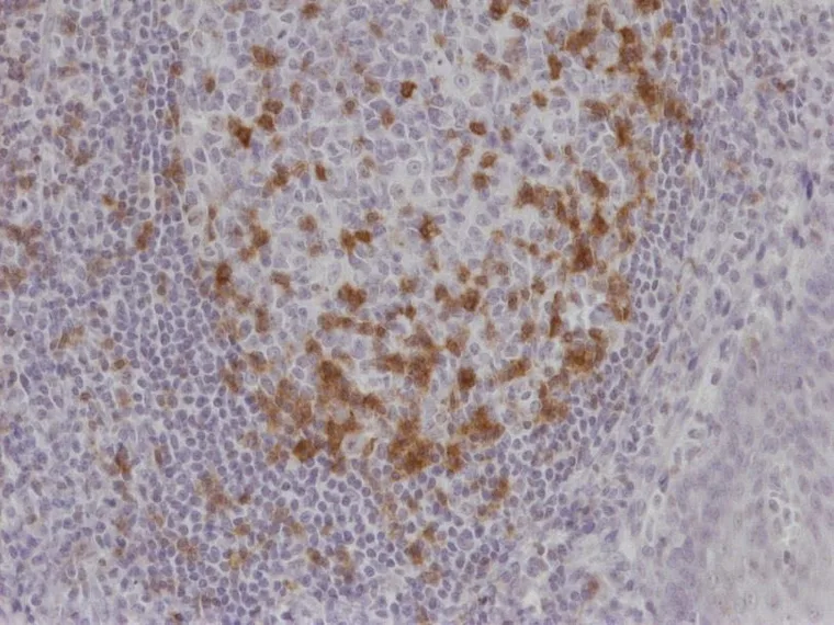 Microphotographs of TG-1 immunostaining on human tonsil at 100×, 200× and 400× (ONCOdianova reference images, Tech Note V1, Fig. 1). – 200×