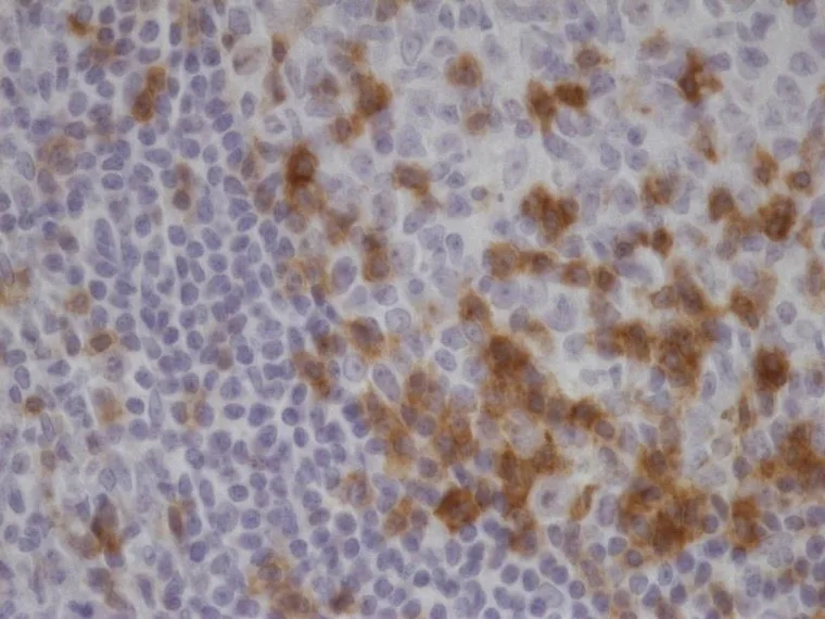 Microphotographs of TG-1 immunostaining on human tonsil at 100×, 200× and 400× (ONCOdianova reference images, Tech Note V1, Fig. 1). – 400×