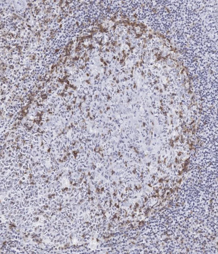 Immunohistochemistry of human TIGIT in FFPE tonsil using clone TG2 – normal human tonsil with numerous TIGIT-positive lymphocytes (ONCOdianova reference image, datasheet DIA-TG2-M V05).